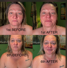 Load image into Gallery viewer, Extensive Buccal Facelift With Lymphatic Drainage & Myofacial Release Treatment (Includes LED Light Therapy) 100 Minutes