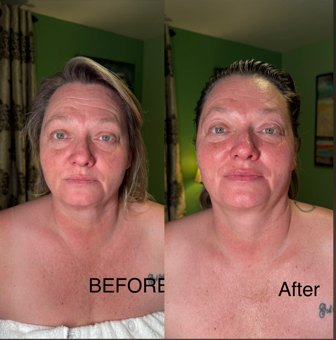 Extensive Buccal Facelift With Lymphatic Drainage & Myofacial Release Treatment (Includes LED Light Therapy) 100 Minutes