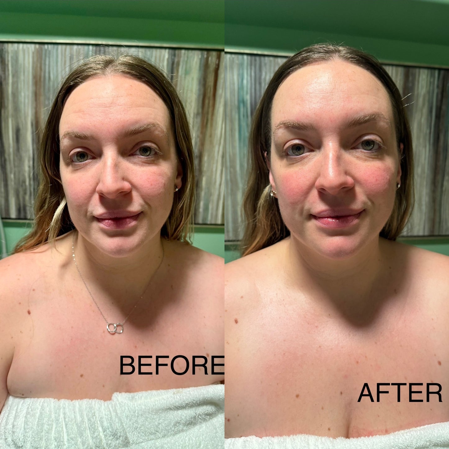Extensive Buccal Facelift With Lymphatic Drainage & Myofacial Release Treatment (Includes LED Light Therapy) 100 Minutes