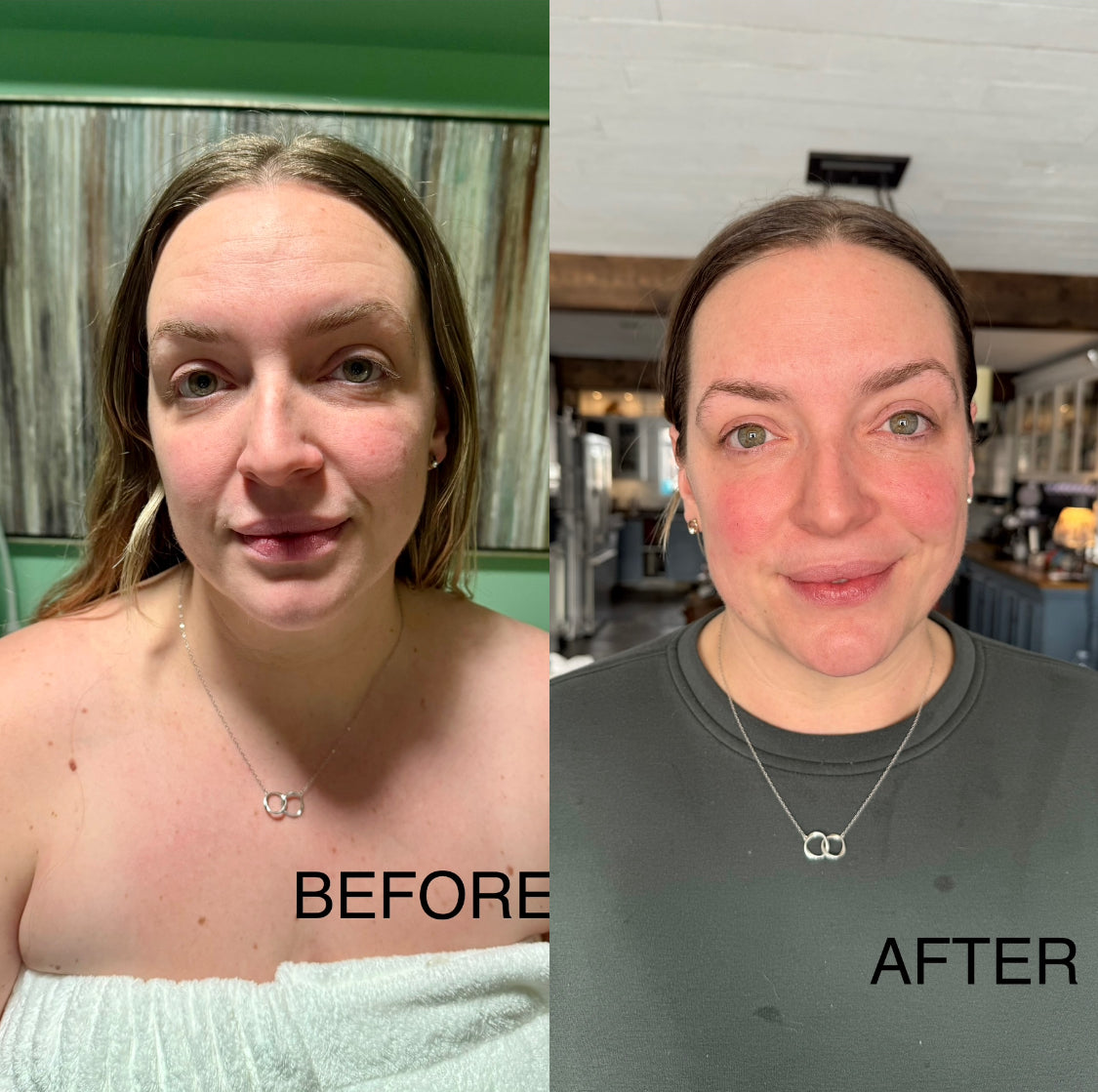 Extensive Buccal Facelift With Lymphatic Drainage & Myofacial Release Treatment (Includes LED Light Therapy) 100 Minutes