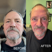 Load image into Gallery viewer, Extensive Buccal Facelift With Lymphatic Drainage &amp; Myofacial Release Treatment (Includes LED Light Therapy) 100 Minutes
