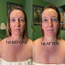 Load image into Gallery viewer, Extensive Buccal Facelift With Lymphatic Drainage &amp; Myofacial Release Treatment (Includes LED Light Therapy) 100 Minutes
