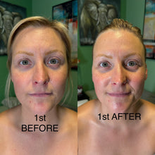 Load image into Gallery viewer, Extensive Buccal Facelift With Lymphatic Drainage &amp; Myofacial Release Treatment (Includes LED Light Therapy) 100 Minutes
